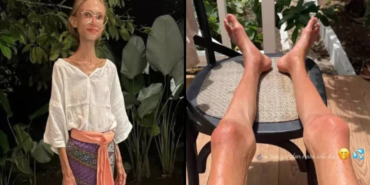 meyvecilik akimi hayatina mal oldu 2I2V53PZ