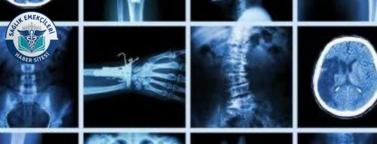 radyoloji-skandali-iddiasi-savcilik-harekete-gecti-yanlis-raporlar-mercek-altinda-saglik-emekcileri-haber-kanali-nWAtQ1g9.png